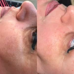  خدمات تخصصی پاکسازی پوست ساجده عنایتی
