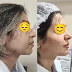 کلینیک زیبایی پوست و لیزر ایده آل