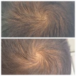 تصویر کلینیک پوست مو لیزر سیمارز