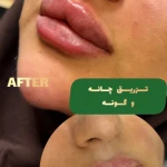 کلینیک زیبایی پوست مو لیزر اریکا