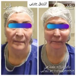 تصویر متخصص پوست مو زیبایی لیزر دکتر فرزانه علمشاهی