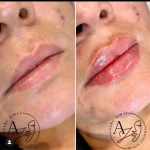 کلینیک پوست مو لیزر و لاغری عصر زیبایی