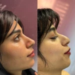 مرکز لیزر و زیبایی هانیسا