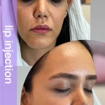 کلینیک پوست موزیبایی ولیزر(بانوان) فرتاب