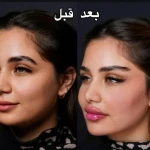 تصویر کلینیک زیبایی و فیشال ویونا سلامت