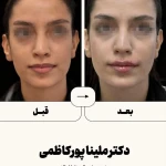 مطب  دکتر ملینا پورکاظمی