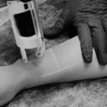 کلینیک زیبایی و لیزر مو دکتر سمانه وطن دوست