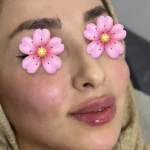 تصویر خانه لیزر فیلر و بوتاکس ثنا