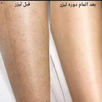 مرکز لیزر  موی زائد دکتر قطریفی