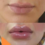 نمونه کار مرکز لیزر و کلینیک زیبایی دلارا
