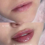 مرکز پوست و مو و لیزر دکتر مهتاب رضوی