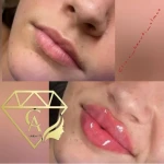 کلینیک زیبایی و لیزر الماس