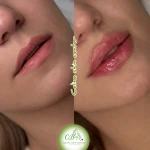 کلینیک زیبایی‌ سلین اسکین سنتر