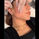 کلینیک زیبایی و مرکز لیزر نورا