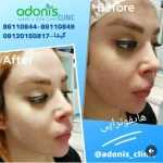کلینیک پوست مو زیبایی و لیزر آدونیس