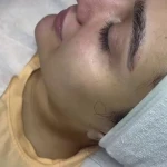 خدمات تخصصی پاکسازی پوست هدیه حامدی