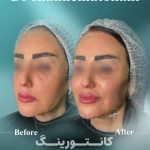 مطب پوست زيبايی ليزر دکتر شاه نعمت الهی
