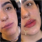 نمونه کار کلینیک پوست مو زیبایی و لیزر کیمیا