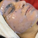 کلینیک  لیزر موهای زائد و زیبایی مهرنیا