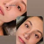کاشت مژه و لیفت ابرو فرناز