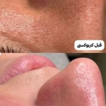 خدمات فوق تخصصی پوست مژگان صالحی