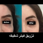 نمونه کار مرکز پوست،مو وزیبایی دکتر فرنوش میلانی