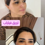 کیلینیک فوق تخصصی پوست ، مو ، زیبایی آراد