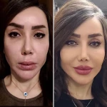 کلینیک پوست مو زیبایی و لیزر سارا