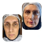 نمونه کار مرکز زیبایی ساریه امیدی