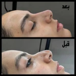 کلینیک پوست مو زیبایی و لیزر کیمیا