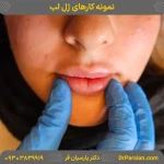 نمونه کار کلینیک زیبایی دکتر سعید پارسیان فر
