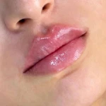 کلینیک زیبایی و لیزر مو گندم