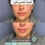 نمونه کار مجموعه زیبایی فلورا پوست مو زیبایی