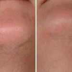 کلینیک لیزر و زیبایی یگانه