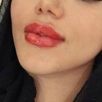مطب پوست،مو ، زیبایی ولیزر