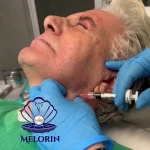 کلینیک پوست و مو ملورین  دکتر محمدی