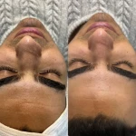  خدمات تخصصی پاکسازی پوست ساجده عنایتی