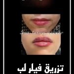 مرکز کلینیک لیزر زیبایی پوست و مو آسا