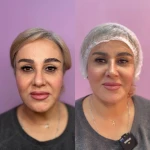کلینیک پوست مو و زیبایی دکتر زلفی