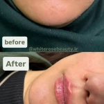 نمونه کار کلینیک زیبایی رز سفید