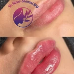 مطب زیبایی دکتر مینو شعبانی