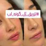 کلینیک زیبایی molaye