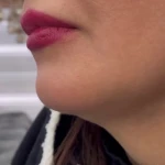 کلینیک زیبایی رایکا