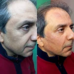 تصویر کلینیک زیبایی پارسیان آلفا