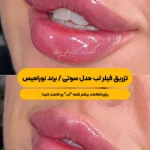 کلینیک زیبایی بلا
