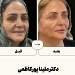 نمونه کار مطب  دکتر ملینا پورکاظمی