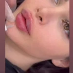 نمونه کار کلینیک زیبایی و فیشال ویونا سلامت