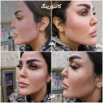کلینیک زیبایی و لیزر مو گندم
