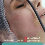 کلینیک تخصصی پوست مو زیبایی و لیزر هانا
