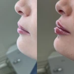 کلینیک لیزر , زیبایی و لاغری نوران